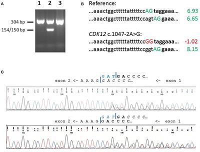 A Splice Site Variant of CDK12 and Breast Cancer in Three Eurasian Populations